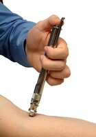 Algemene Informatie Dermojet®