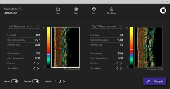 Ultrasound scherm software