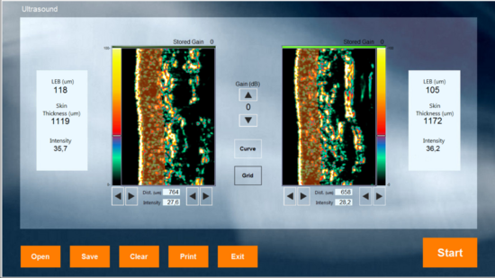 DermaLab schermvoorbeeld Ultrasound