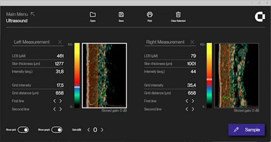 DL Scherm Ultrasound 20 MHz