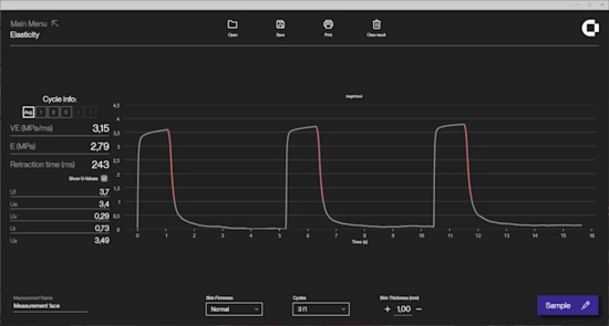 DL Scherm Elasticity