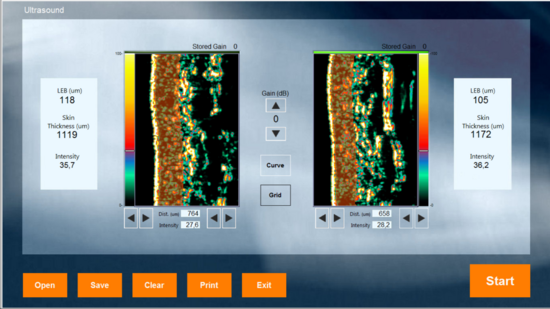 DermaLab Combo schermvoorbeeld Ultrasound