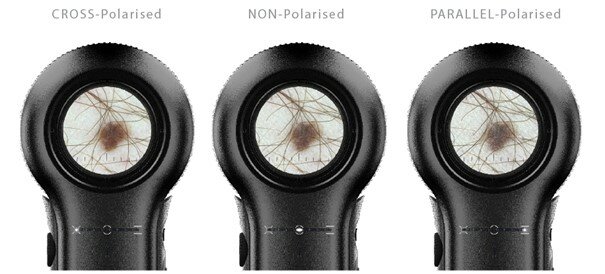 variabel polarisatiesysteem in hybride dermatoscoop