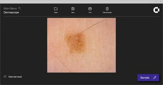 DermaScope Camera sw