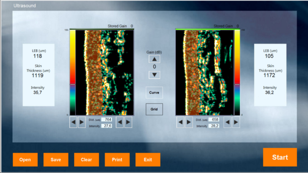 DermaLab schermvoorbeeld Ultrasound