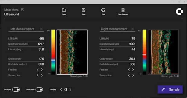 DL Scherm Ultrasound 20 MHz