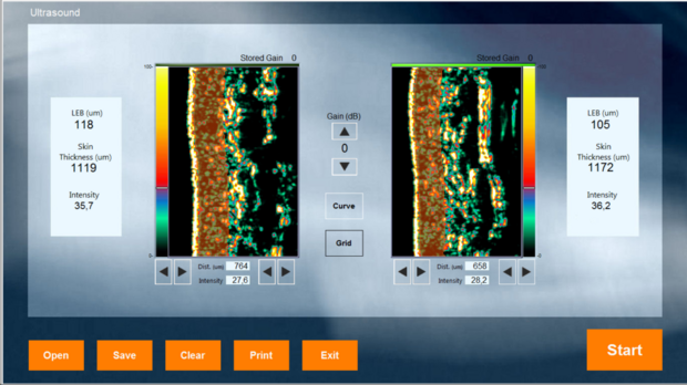 DermaLab Combo schermvoorbeeld Ultrasound